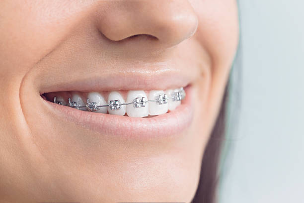 Best Teeth Whitening  in Columbiana, AL